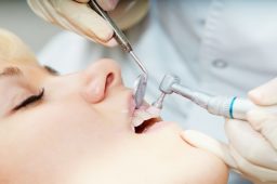 Your Dentist in Madison, WI Provides Sleep Apnea Treatment