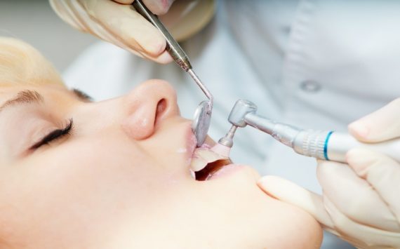 Facts about Tooth Bridges in Philadelphia