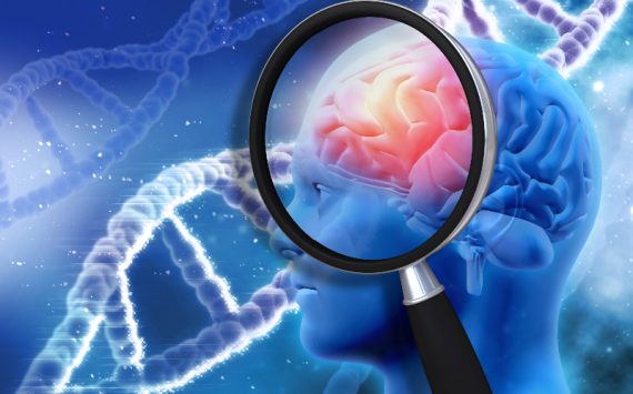 What to Know About a TBI Specialist in Atlanta, GA