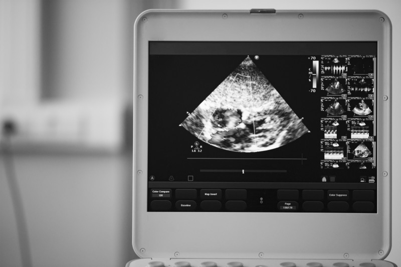 Utilize a South Carolina Company Providing Ultrasound Machine Maintenance