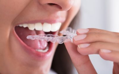 Transform Your Smile With Invisalign For Adults In Round Rock TX And Boost Your Self Confidence