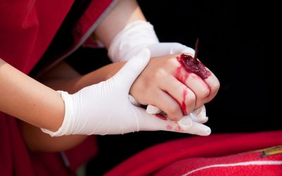 Common Mistakes to Avoid With an Auto Accident Lawyer in Poughkeepsie, NY, Handling Your Case